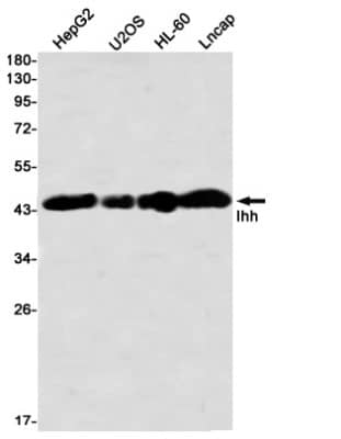 Western Blot: Indian Hedgehog/Ihh Antibody (S03-3F2) [NBP3-19878]