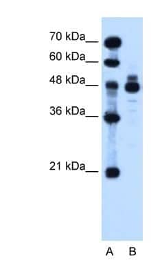 Western Blot: Indian Hedgehog/Ihh Antibody [NBP1-59443]