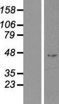 Western Blot: Indian Hedgehog/Ihh Overexpression Lysate [NBP2-10812]