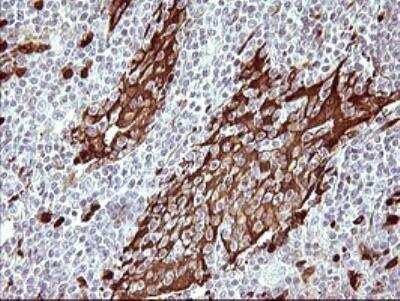 Immunohistochemistry-Paraffin: Indoleamine 2,3-dioxygenase/IDO Antibody (OTI2B5) [NBP2-46020]