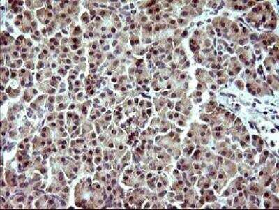 Immunohistochemistry-Paraffin: Indoleamine 2,3-dioxygenase/IDO Antibody (OTI2B5) [NBP2-46020]