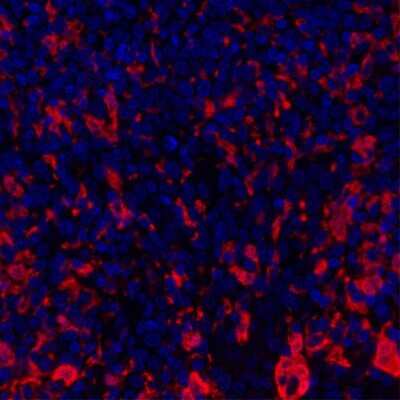 Immunocytochemistry/ Immunofluorescence: Indoleamine 2,3-dioxygenase/IDO Antibody (BLR031F) [NBP2-76404]
