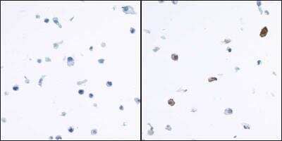 Immunocytochemistry/ Immunofluorescence: Indoleamine 2,3-dioxygenase/IDO Antibody (BLR031F) [NBP2-76404]