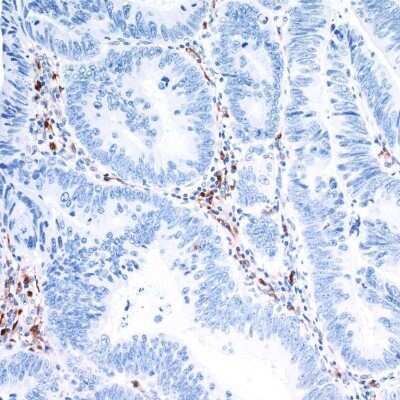 Immunohistochemistry-Paraffin: Indoleamine 2,3-dioxygenase/IDO Antibody (BLR031F) [NBP2-76404]