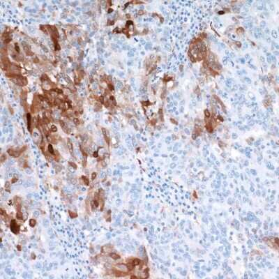 Immunohistochemistry-Paraffin: Indoleamine 2,3-dioxygenase/IDO Antibody (BLR031F) [NBP2-76404]