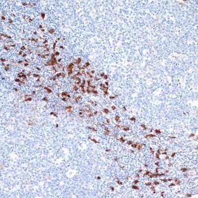 Immunohistochemistry-Paraffin: Indoleamine 2,3-dioxygenase/IDO Antibody (BLR031F) [NBP2-76404]