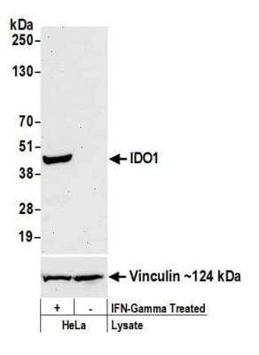 Western Blot: Indoleamine 2,3-dioxygenase/IDO Antibody (BLR040F) [NBP2-76408]