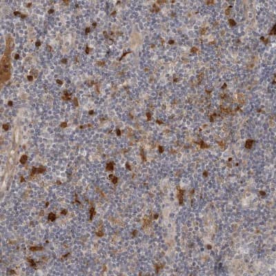 Immunohistochemistry-Paraffin: Indoleamine 2,3-dioxygenase/IDO Antibody [NBP1-87701]