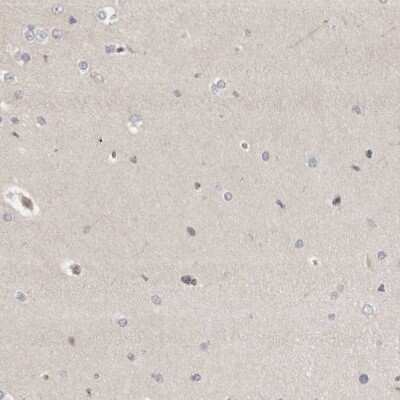 Immunohistochemistry-Paraffin: Indoleamine 2,3-dioxygenase/IDO Antibody [NBP1-87701]