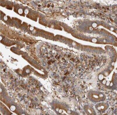 Immunohistochemistry-Paraffin: Indoleamine 2,3-dioxygenase/IDO Antibody [NBP1-87701]