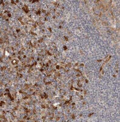 Immunohistochemistry-Paraffin: Indoleamine 2,3-dioxygenase/IDO Antibody [NBP1-87701]