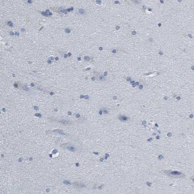 Immunohistochemistry-Paraffin: Indoleamine 2,3-dioxygenase/IDO Antibody [NBP1-87702]