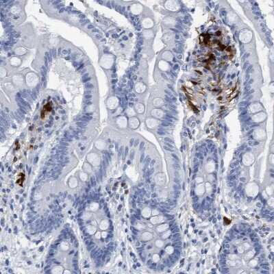 Immunohistochemistry-Paraffin: Indoleamine 2,3-dioxygenase/IDO Antibody [NBP1-87702]