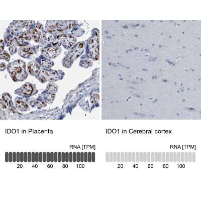 Immunohistochemistry-Paraffin: Indoleamine 2,3-dioxygenase/IDO Antibody [NBP1-87702]