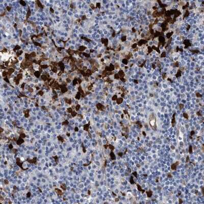Immunohistochemistry-Paraffin: Indoleamine 2,3-dioxygenase/IDO Antibody [NBP1-87702]