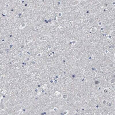 Immunohistochemistry-Paraffin: Indoleamine 2,3-dioxygenase/IDO Antibody [NBP1-87703]