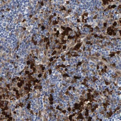 Immunohistochemistry-Paraffin: Indoleamine 2,3-dioxygenase/IDO Antibody [NBP1-87703]