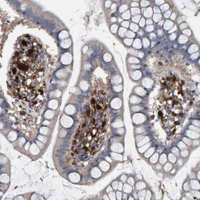 Immunohistochemistry-Paraffin: Indoleamine 2,3-dioxygenase/IDO Antibody [NBP1-87703]