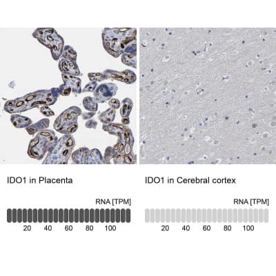 Immunohistochemistry-Paraffin: Indoleamine 2,3-dioxygenase/IDO Antibody [NBP1-87703]