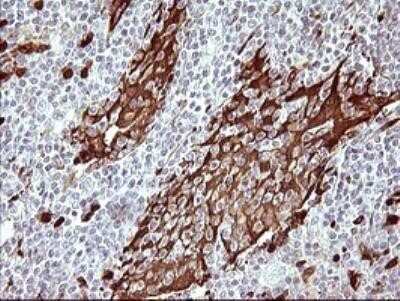 Immunohistochemistry: Indoleamine 2,3-dioxygenase/IDO Antibody (OTI2B5) - Azide and BSA Free [NBP2-71038]