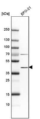 Western Blot: Indoleamine 2,3-dioxygenase/IDO Antibody [NBP1-87702]