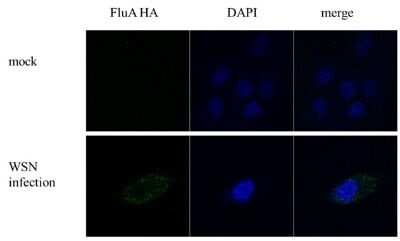 Immunocytochemistry/ Immunofluorescence: Influenza A H1N1 Hemagglutinin Antibody (GT223) - (A/WSN/1933) [NBP3-13497]