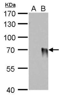 Western Blot: Influenza A H1N1 Hemagglutinin Antibody (GT223)(A/WSN/1933) [NBP3-13497]