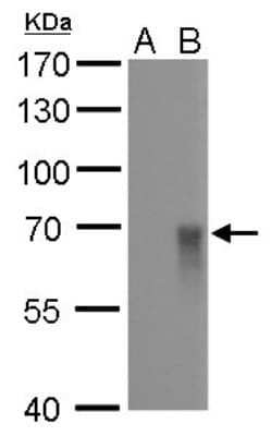Western Blot: Influenza A H1N1 Hemagglutinin Antibody (GT521)(A/WSN/1933) [NBP3-13496]