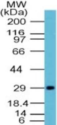 Western Blot: Influenza A H1N1 Hemagglutinin Antibody [NBP2-24956]