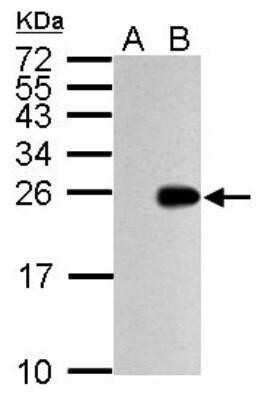 Western Blot: Influenza A H1N1 M1 Antibody(A/Puerto Rico/8/1934) [NBP2-14995]