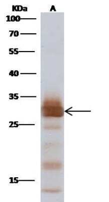 Western Blot: Influenza A H1N1 M1 Antibody(A/Puerto Rico/8/34/Mount Sinai) [NBP3-12721]