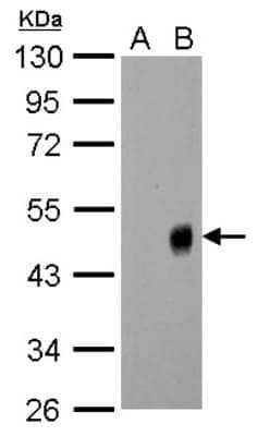 Western Blot: Influenza A H1N1 Neuraminidase Antibody(A/WSN/1933) [NBP2-42870]