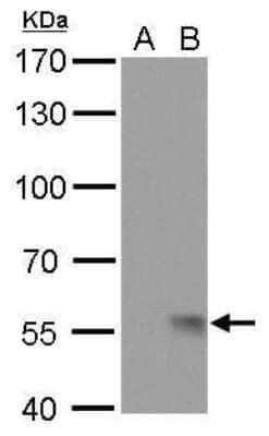 Western Blot: Influenza A H1N1 Neuraminidase Antibody (GT172)(A/WSN/1933) [NBP3-13494]