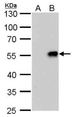 Western Blot: Influenza A H1N1 Neuraminidase Antibody (GT288)(A/WSN/1933) [NBP3-13495]