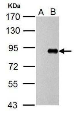 Western Blot: Influenza A H1N1 PB1 Antibody [NBP2-42877]