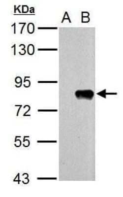 Western Blot: Influenza A H1N1 PB2 Antibody [NBP2-42879]