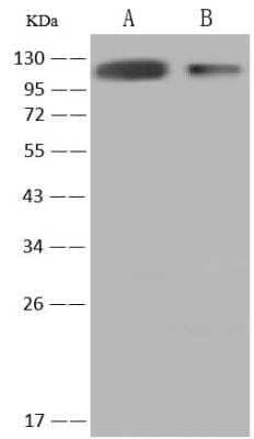 Western Blot: Influenza A H3N2 Hemagglutinin Antibody(A/Brisbane/10/2007) [NBP3-12797]