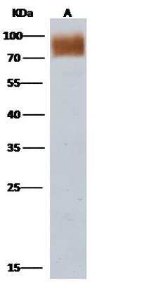 Western Blot: Influenza A H3N2 Neuraminidase Antibody [NBP3-12723]