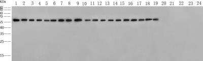 Western Blot: Influenza A nucleoprotein Antibody (010) [NBP3-12741]