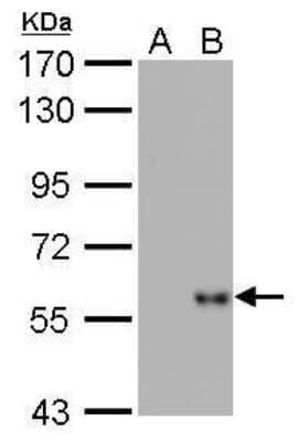 Western Blot: Influenza A H1N1 Nucleoprotein Antibody (GT1236)(A/WSN/1933) [NBP3-13493]