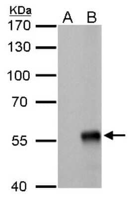 Western Blot: Influenza A H1N1 Nucleoprotein Antibody (GT778)(A/WSN/1933) [NBP3-13492]
