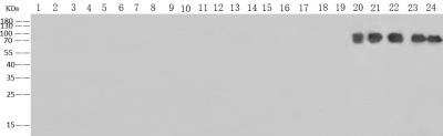 Western Blot: Influenza B nucleoprotein Antibody (016) [NBP3-12755]