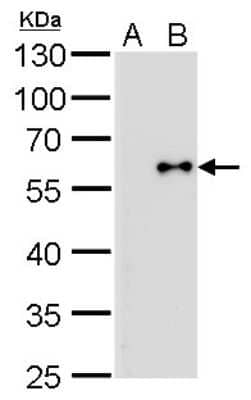 Western Blot: Influenza B nucleoprotein Antibody (GT371)(B/Taiwan/753/2005) [NBP3-13499]