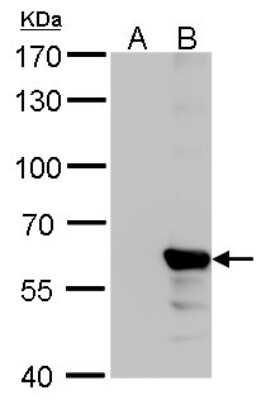 Western Blot: Influenza B nucleoprotein Antibody (GT382)(B/Taiwan/753/2005) [NBP3-13500]