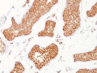 Immunohistochemistry-Paraffin: Inhibin alpha Antibody (INHA/1168) - Azide and BSA Free [NBP3-08669]