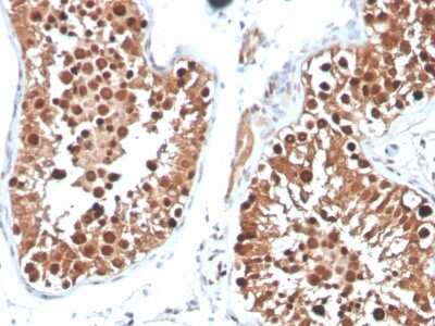 Immunohistochemistry-Paraffin: Inhibin alpha Antibody (INHA/4265) - Azide and BSA Free [NBP3-08676]