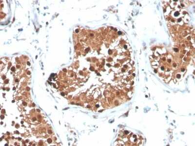 Immunohistochemistry-Paraffin: Inhibin alpha Antibody (INHA/4265) - Azide and BSA Free [NBP3-08676]