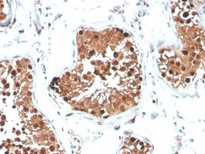 Immunohistochemistry-Paraffin: Inhibin alpha Antibody (INHA/4265) [NBP3-07434]