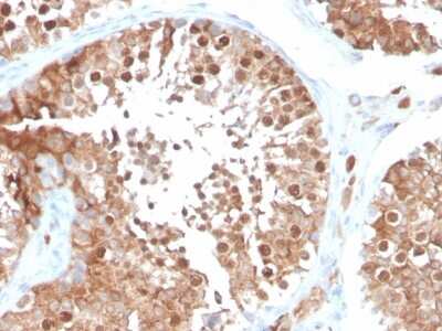 Immunohistochemistry-Paraffin: Inhibin alpha Antibody (INHA/4266) - Azide and BSA Free [NBP3-08780]