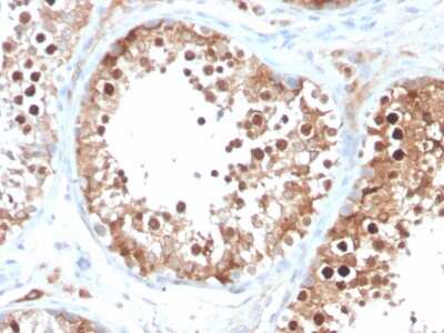 Immunohistochemistry-Paraffin: Inhibin alpha Antibody (INHA/4266) - Azide and BSA Free [NBP3-08780]